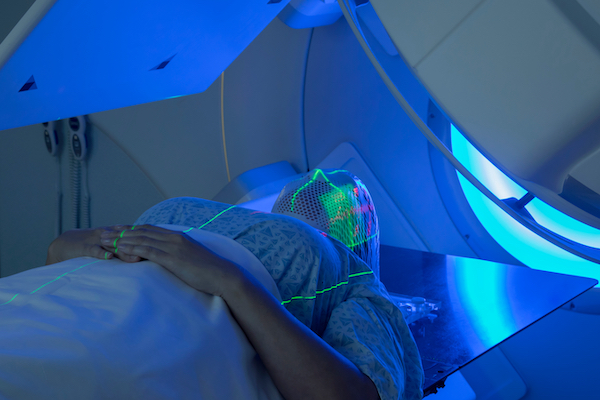Valuation of Linear Accelerators